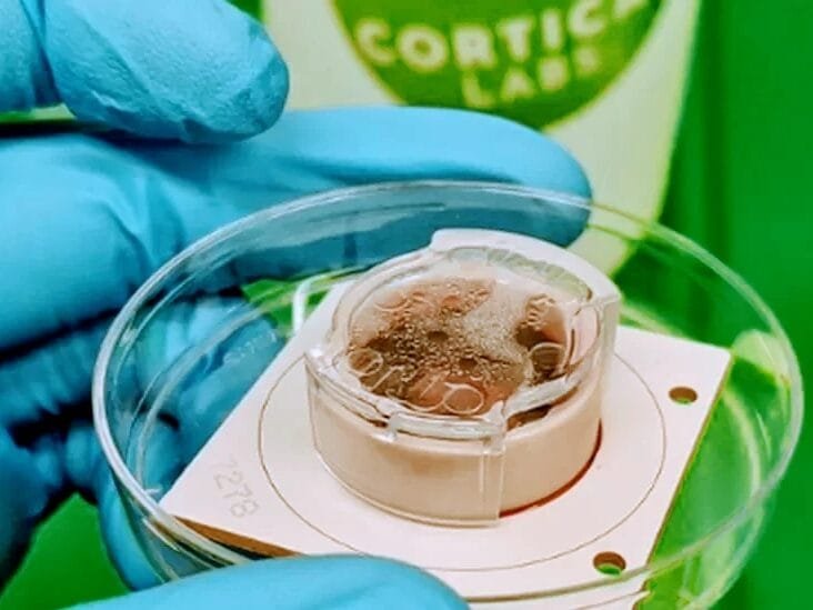 The lab-grown braincells, that learned to play pong.